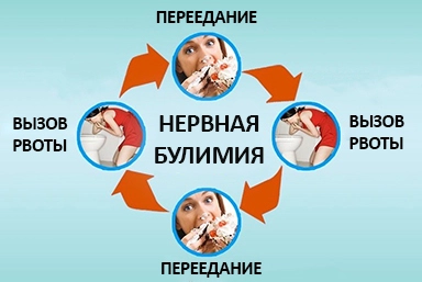 Лечение булимии в Краснозатонском